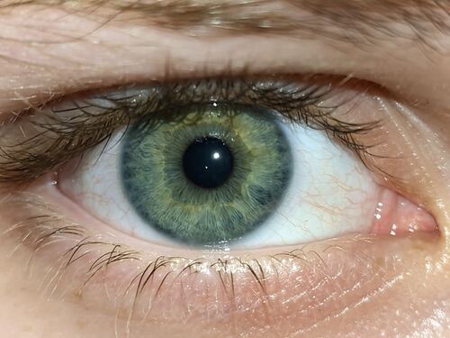 eye
